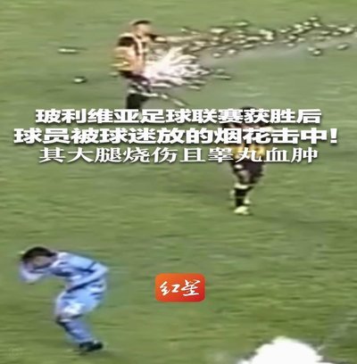梅斯19岁足球小将冲入火场救出女友，他全身三成皮肤被烧伤